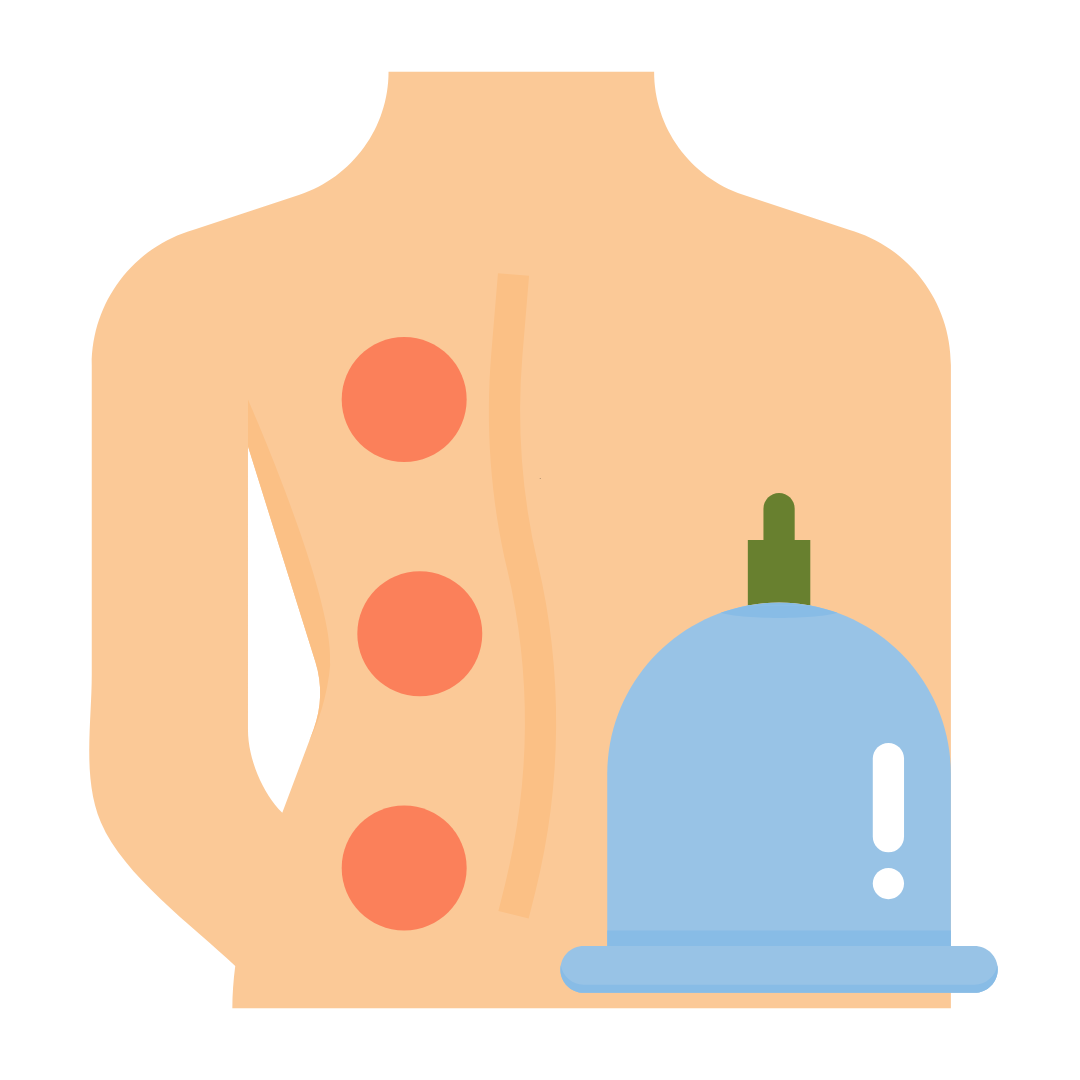 Cupping Therapy