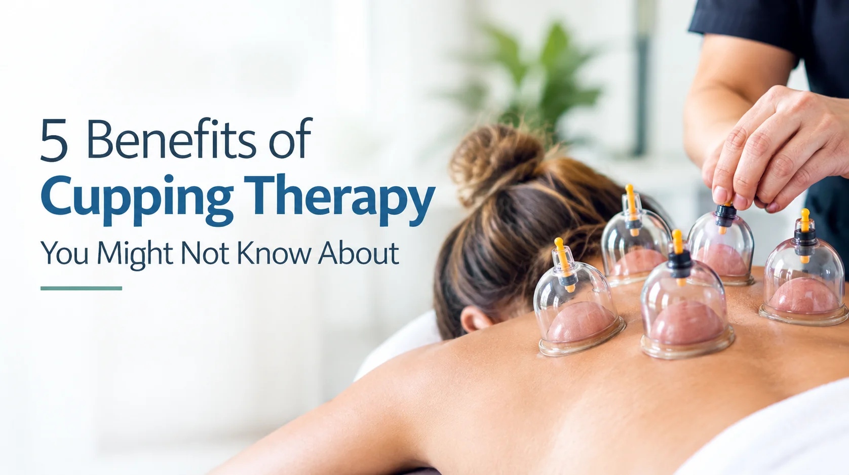 5 Benefits of Cupping Therapy You Might Not Know About